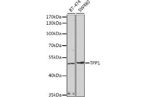 Western blot analysis of extracts of various cell lines, using TPP1 antibody (ABIN6127693, ABIN6149442, ABIN6149443 and ABIN6221263) at 1:1000 dilution. (TPP1 antibody  (AA 284-563))