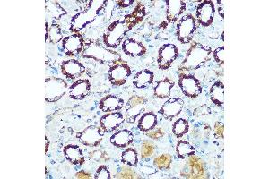 Immunohistochemistry of paraffin-embedded rat kidney using COX5B Rabbit pAb (ABIN3016355, ABIN3016356, ABIN3016357 and ABIN6219733) at dilution of 1:100 (40x lens). (COX5B antibody  (AA 32-129))