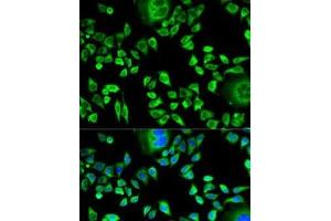 Immunofluorescence analysis of HeLa cells using CSTA Polyclonal Antibody (CSTA antibody)