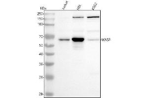 Western blot analysis of WASP using anti-WASP antibody (ABIN7606709).
