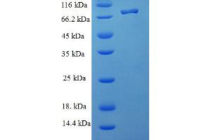 NOP58 Ribonucleoprotein (NOP58) (AA 1-529), (full length) protein (His-SUMO Tag)