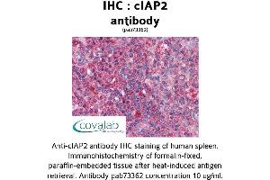 Image no. 1 for anti-Baculoviral IAP Repeat Containing 3 (BIRC3) (AA 314-508) antibody (ABIN1733088) (BIRC3 antibody  (AA 314-508))