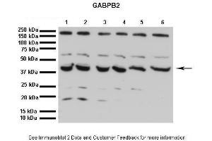 Lanes:   1. (GABPB2 antibody  (C-Term))