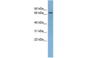 WB Suggested Anti-NDUFS1 Antibody Titration: 0. (NDUFS1 antibody  (Middle Region))