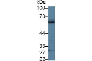 Detection of ABI1 in Porcine Liver lysate using Polyclonal Antibody to Abl Interactor 1 (ABI1) (ABI1 antibody  (AA 1-182))