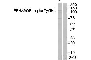Western blot analysis of extracts from JK cells, using EPHA2/5 (Phospho-Tyr594) Antibody. (EPHA2/5 (pTyr594) antibody)