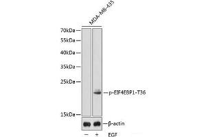 Western blot analysis of extracts from MDA-MB-435 cells using Phospho-EIF4EBP1(T36) Polyclonal Antibody. (eIF4EBP1 antibody  (pThr36))