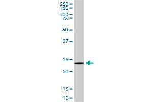 UCHL3 monoclonal antibody (M01), clone 4E9. (UCHL3 antibody  (AA 131-230))