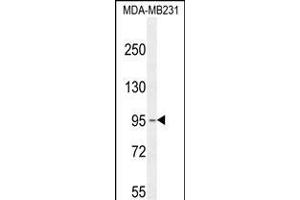 KCNT2 Antibody (C-term) (ABIN654309 and ABIN2844095) western blot analysis in MDA-M cell line lysates (35 μg/lane). (KCNT2 antibody  (C-Term))