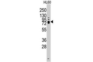 Western blot analysis of Trpv3 polyclonal antibody  in HL-60 cell line lysates (35 ug/lane).