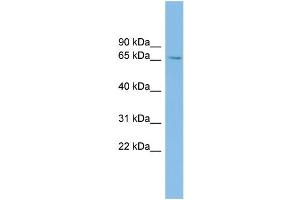 WB Suggested Anti-SLC6A1 Antibody Titration: 0. (SLC6A1 antibody  (Middle Region))