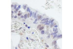anti-Ring Finger Protein 20 (RNF20) (AA 125-175) antibody