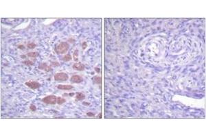Immunohistochemistry (IHC) image for anti-Neutrophil Cytosolic Factor 4, 40kDa (NCF4) (AA 120-169) antibody (ABIN2888743) (NCF4 antibody  (AA 120-169))
