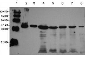 Lane 1: EasyWestern Protein Standard   Lane 2: Rabbit muscular tissue lysateLane 3: Fish tissue lysateLane 4: Cow muscular tissue lysateLane 5: Pig muscular tissue lysateLane 6: Rat brain tissue lysateLane 7: 3T3 cell lysateLane 8: Hela cell lysate Primary antibody: 1 µg/mL Rabbit Anti-alpha-Actin-1 Polyclonal Antibody (ABIN398560) Secondary antibody: Goat Anti-Rabbit IgG (H&L) [HRP] Polyclonal Antibody (ABIN398323, 1: 10,000) (Actin antibody)