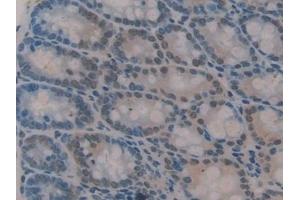 Detection of GLI3 in Mouse Colon Tissue using Polyclonal Antibody to GLI Family Zinc Finger Protein 3 (GLI3) (GLI Family Zinc Finger Protein 3 (AA 303-561) antibody)