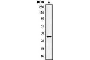 Western blot analysis of Kallikrein 3 expression in LNCaP (A) whole cell lysates. (Prostate Specific Antigen antibody  (Center))