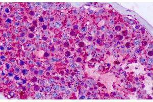 Anti-CELSR1 antibody IHC staining of human testis. (CELSR1 antibody  (C-Term))