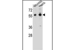 TRIM64 Antibody (C-term) (ABIN657217 and ABIN2837912) western blot analysis in NCI-,HepG2 cell line lysates (35 μg/lane). (TRIM64 antibody  (C-Term))