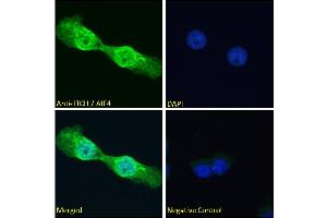 Immunofluorescence (IF) image for anti-Itchy E3 Ubiquitin Protein Ligase Homolog (ITCH) (Internal Region) antibody (ABIN334426)