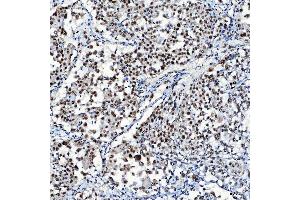 IHC analysis of SF3A1 using anti-SF3A1 antibody (ABIN7600556). (SF3A1 antibody  (AA 20-556))