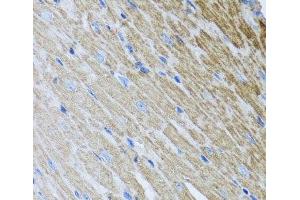Immunohistochemistry of paraffin-embedded Mouse heart using MTX2 Polyclonal Antibody at dilution of 1:100 (40x lens). (MTX2 antibody)