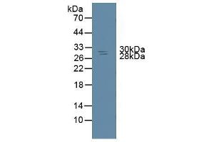 Detection of NME6 in Rat Spleen Tissue using Polyclonal Antibody to Non Metastatic Cells 6, Protein Expressed In (NME6) (NME6 antibody  (AA 1-173))