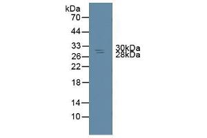 Detection of NME6 in Rat Spleen Tissue using Polyclonal Antibody to Non Metastatic Cells 6, Protein Expressed In (NME6) (Non Metastatic Cells 6, Protein Expressed In (AA 1-173) antibody)