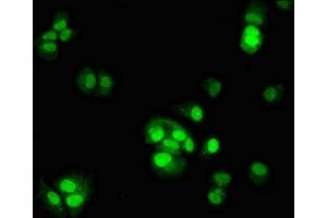 Immunofluorescent analysis of MCF-7 cells using ABIN7164202 at dilution of 1:100 and Alexa Fluor 488-congugated AffiniPure Goat Anti-Rabbit IgG(H+L) (TSR2 antibody  (AA 1-191))