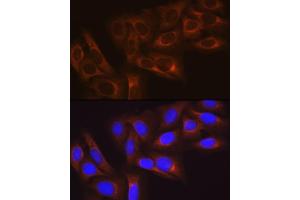 Immunofluorescence analysis of U-2 OS cells using HSP27/HSPB1Rabbit mAb (ABIN7267569) at dilution of 1:100 (40x lens). (HSP27 antibody)