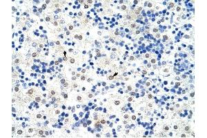 HNRPL antibody was used for immunohistochemistry at a concentration of 4-8 ug/ml to stain Hepatocytes (arrows) in Human Liver. (HNRNPL antibody  (N-Term))