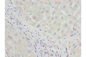 Immunohistochemistry of paraffin-embedded human liver tissue using ABIN7154996 at dilution of 1:100 (HBZ antibody  (AA 1-142))