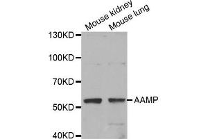 Western Blotting (WB) image for anti-Angio-Associated, Migratory Cell Protein (AAMP) antibody (ABIN1875463) (AAMP antibody)