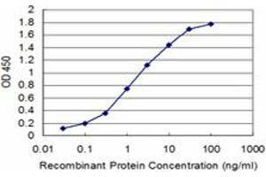 Detection limit for recombinant GST tagged ATP7B is approximately 0. (ATP7B antibody  (AA 1372-1465))