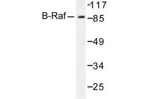 Image no. 2 for anti-B-Raf proto-oncogene, serine/threonine kinase (BRAF) antibody (ABIN271999) (BRAF antibody)