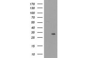 HEK293T cells were transfected with the pCMV6-ENTRY control (Left lane) or pCMV6-ENTRY NMNAT1 (Right lane) cDNA for 48 hrs and lysed. (NMNAT1 antibody)
