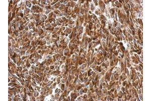 IHC-P Image Immunohistochemical analysis of paraffin-embedded RT2 xenograft, using AGR3, antibody at 1:500 dilution. (AGR3 antibody  (Center))