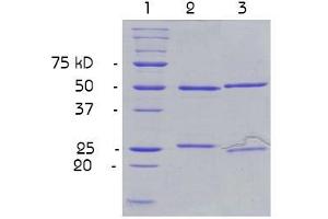 Purity control (SDS PAGE): Polyacrylamide gel 13,5 % under denaturated conditions. (5-Methylcytidine antibody)