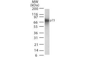 p73 Western Blot. (Tumor Protein p73 antibody)