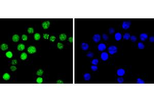 SW480 cells were stained with Cyclin E1(T77) (4G10 ) Monoclonal Antibody  at [1:200] incubated overnight at 4C, followed by secondary antibody incubation, DAPI staining of the nuclei and detection. (Cyclin E1 antibody  (pThr77))