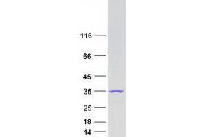 Validation with Western Blot