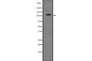 Western blot analysis of EIF4G2 expression in A431 whole cell lysate ,The lane on the left is treated with the antigen-specific peptide. (EIF4G2 antibody  (N-Term))