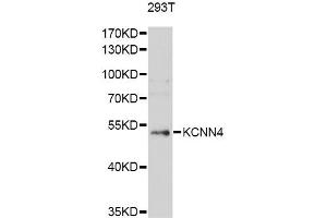 Western blot analysis of extracts of 293T cells, using KCNN4 antibody (ABIN5971024) at 1/1000 dilution. (KCNN4 antibody)