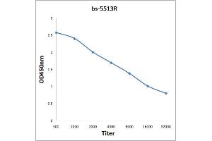 Antigen: 0. (NFKB1 antibody  (pSer893))