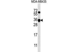 Western Blotting (WB) image for anti-Casein beta (CSN2) antibody (ABIN2996884) (CSN2 antibody)