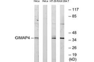 Western Blotting (WB) image for anti-GTPase, IMAP Family Member 4 (GIMAP4) (AA 131-180) antibody (ABIN2890361) (GIMAP4 antibody  (AA 131-180))