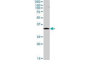 FBXO6 MaxPab rabbit polyclonal antibody.