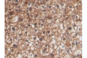 DAB staining on IHC-P; Samples: Human Liver Tissue (HPR antibody  (AA 102-347))