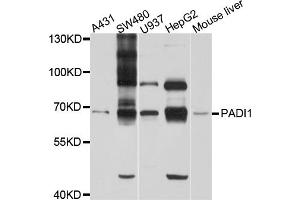 Western blot analysis of extracts of various cell lines, using PADI1 antibody (ABIN6003843) at 1/1000 dilution. (PADI1 antibody)