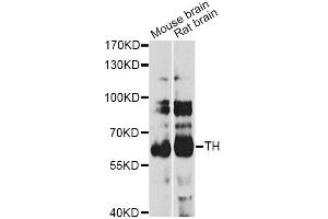 Western blot analysis of extracts of various cell lines, using TH antibody (ABIN2737686) at 1:1000 dilution. (TH antibody)