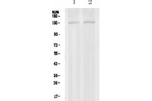 Western blot analysis of PSD using anti-PSD antibody . (PSD antibody  (AA 536-803))